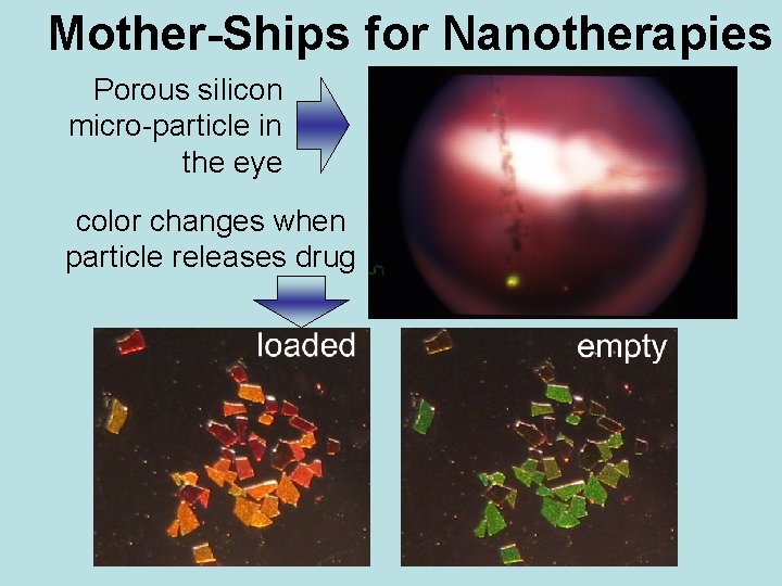 Mother-Ships for Nanotherapies Porous silicon micro-particle in the eye color changes when particle releases