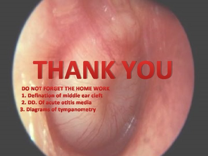 THANK YOU DO NOT FORGET THE HOME WORK 1. Defination of middle ear cleft