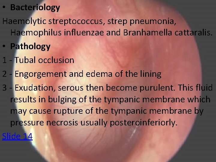  • Bacteriology Haemolytic streptococcus, strep pneumonia, Haemophilus influenzae and Branhamella cattaralis. • Pathology