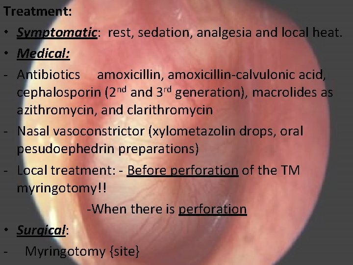 Treatment: • Symptomatic: rest, sedation, analgesia and local heat. • Medical: - Antibiotics amoxicillin,