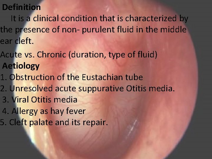 Definition It is a clinical condition that is characterized by the presence of non-