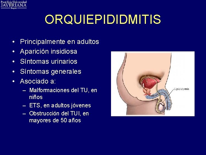 ORQUIEPIDIDMITIS • • • Principalmente en adultos Aparición insidiosa Síntomas urinarios Síntomas generales Asociado