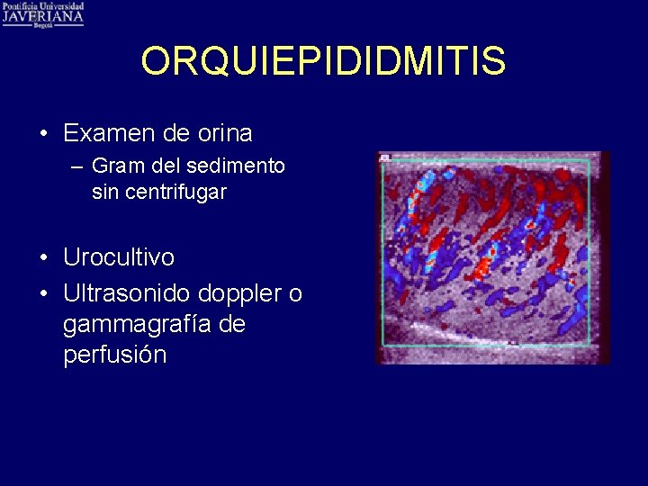 ORQUIEPIDIDMITIS • Examen de orina – Gram del sedimento sin centrifugar • Urocultivo •