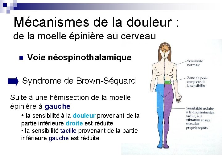 Mécanismes de la douleur : de la moelle épinière au cerveau n Voie néospinothalamique