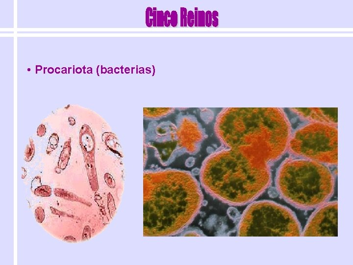  • Procariota (bacterias) 