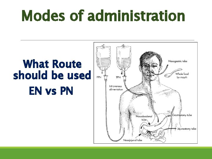 Modes of administration What Route should be used EN vs PN 