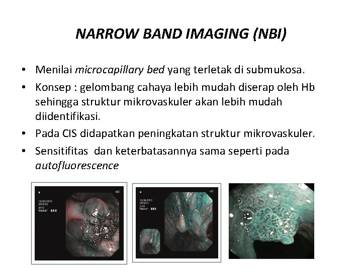 NARROW BAND IMAGING (NBI) • Menilai microcapillary bed yang terletak di submukosa. • Konsep