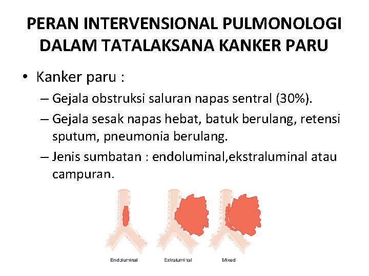 PERAN INTERVENSIONAL PULMONOLOGI DALAM TATALAKSANA KANKER PARU • Kanker paru : – Gejala obstruksi