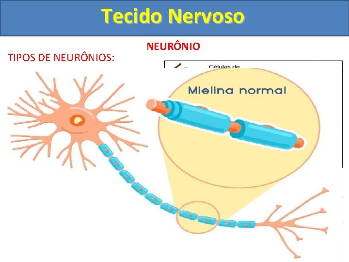 Tecido Nervoso TIPOS DE NEURÔNIOS: NEURÔNIO DE ACORDO COM A PRESENÇA DE BAINHA: •