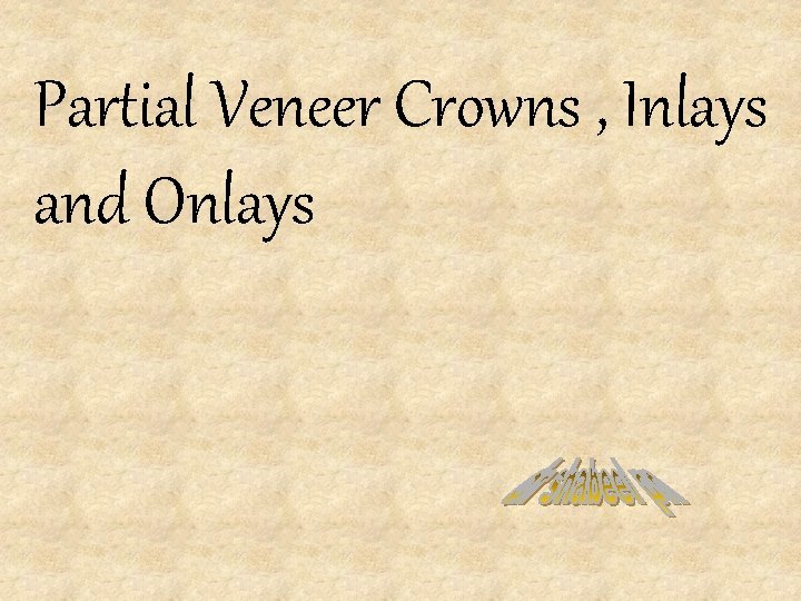 Partial Veneer Crowns , Inlays and Onlays 