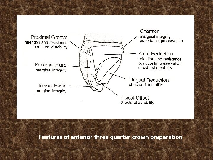 Features of anterior three quarter crown preparation 