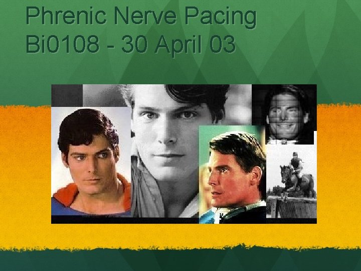 Phrenic Nerve Pacing Bi 0108 - 30 April 03 