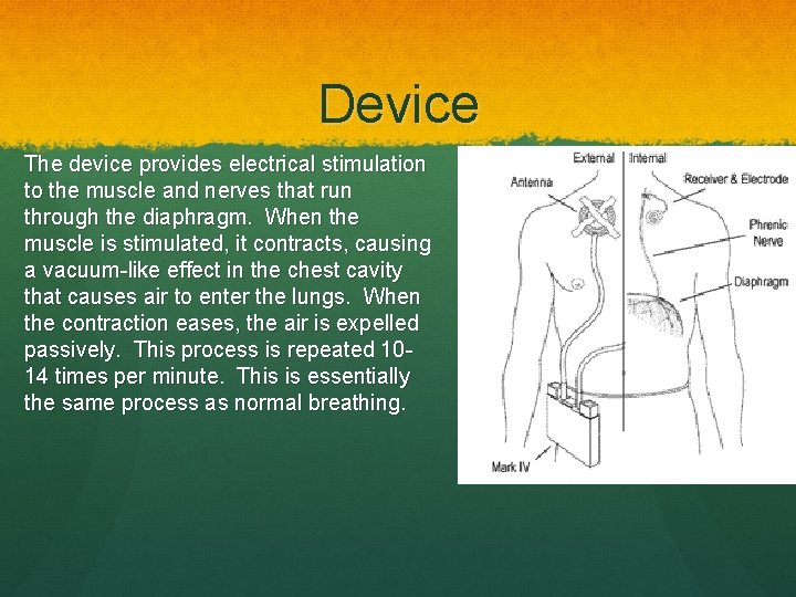 Device The device provides electrical stimulation to the muscle and nerves that run through