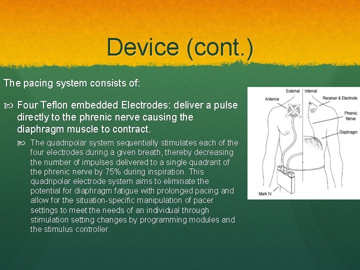 Device (cont. ) The pacing system consists of: Four Teflon embedded Electrodes: deliver a