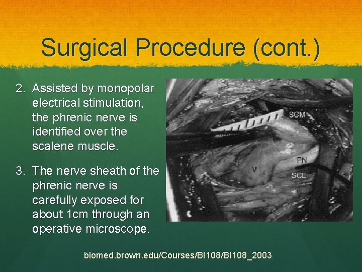 Surgical Procedure (cont. ) 2. Assisted by monopolar electrical stimulation, the phrenic nerve is
