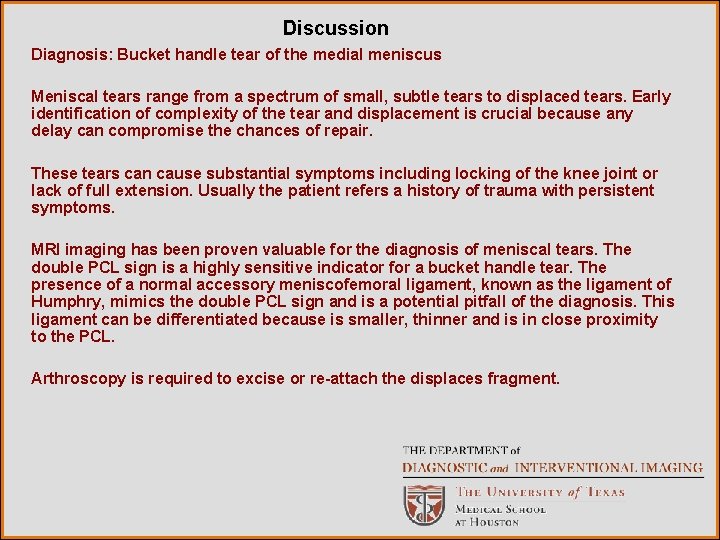 Discussion Diagnosis: Bucket handle tear of the medial meniscus Meniscal tears range from a