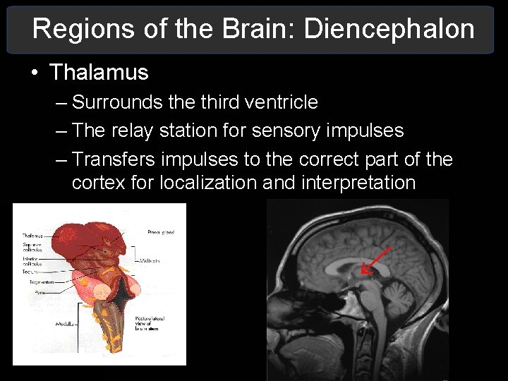 Regions of the Brain: Diencephalon • Thalamus – Surrounds the third ventricle – The Regions of the Brain: Diencephalon • Thalamus – Surrounds the third ventricle – The