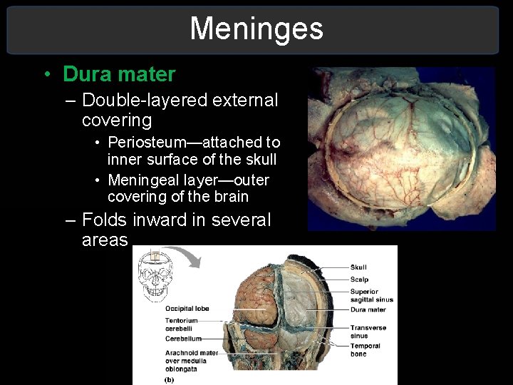 Meninges • Dura mater – Double-layered external covering • Periosteum—attached to inner surface of Meninges • Dura mater – Double-layered external covering • Periosteum—attached to inner surface of