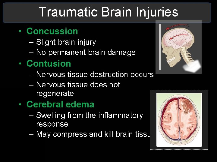 Traumatic Brain Injuries • Concussion – Slight brain injury – No permanent brain damage Traumatic Brain Injuries • Concussion – Slight brain injury – No permanent brain damage
