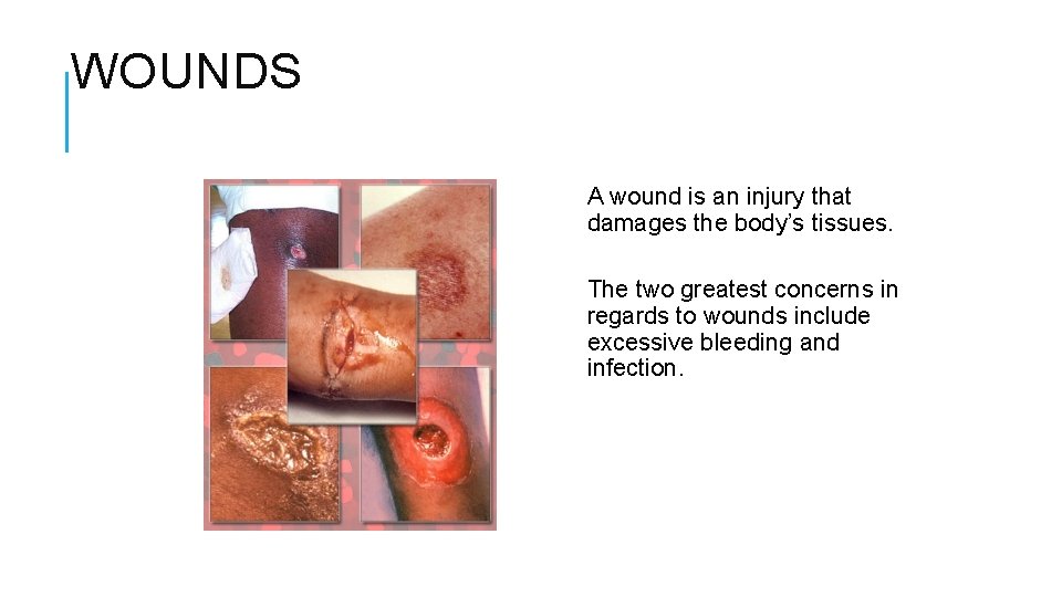 WOUNDS A wound is an injury that damages the body’s tissues. The two greatest