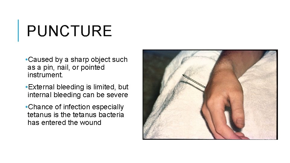 PUNCTURE • Caused by a sharp object such as a pin, nail, or pointed