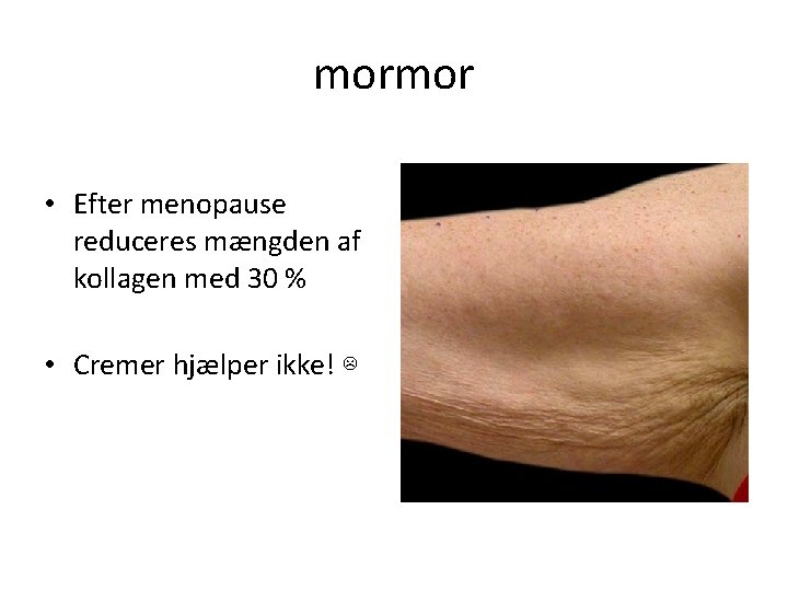 mormor • Efter menopause reduceres mængden af kollagen med 30 % • Cremer hjælper