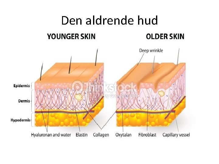 Den aldrende hud 