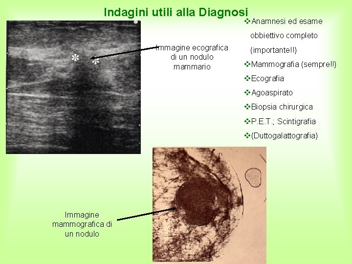 Indagini utili alla Diagnosi Anamnesi ed esame obbiettivo completo Immagine ecografica di un nodulo