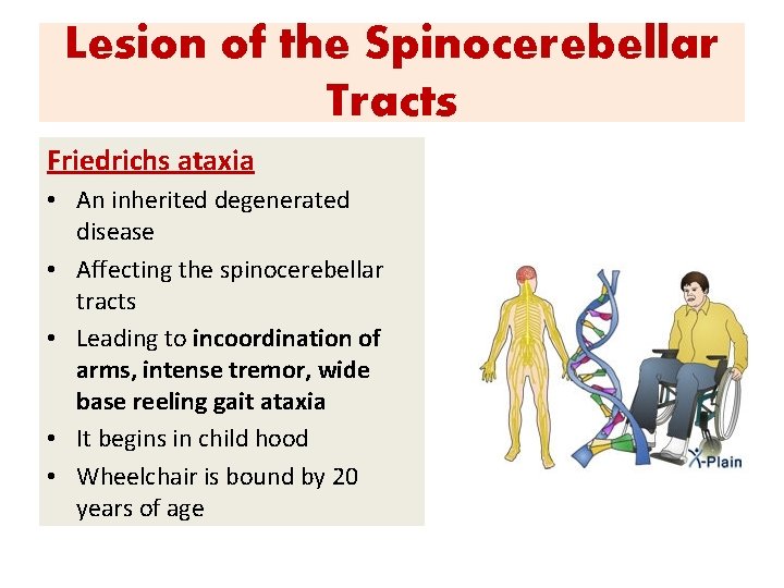 Lesion of the Spinocerebellar Tracts Friedrichs ataxia • An inherited degenerated disease • Affecting