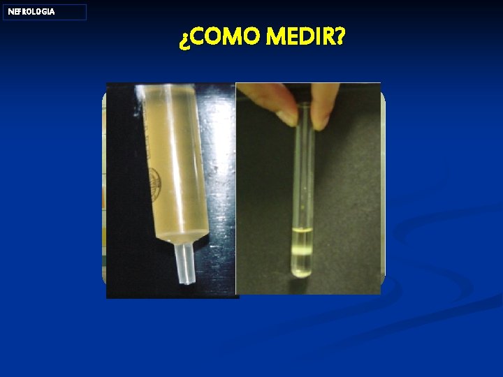 NEFROLOGIA ¿COMO MEDIR? CAMZ 