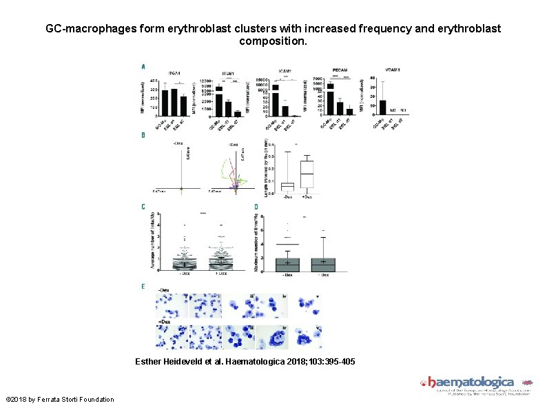 GC-macrophages form erythroblast clusters with increased frequency and erythroblast composition. Esther Heideveld et al.