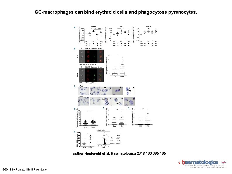 GC-macrophages can bind erythroid cells and phagocytose pyrenocytes. Esther Heideveld et al. Haematologica 2018;