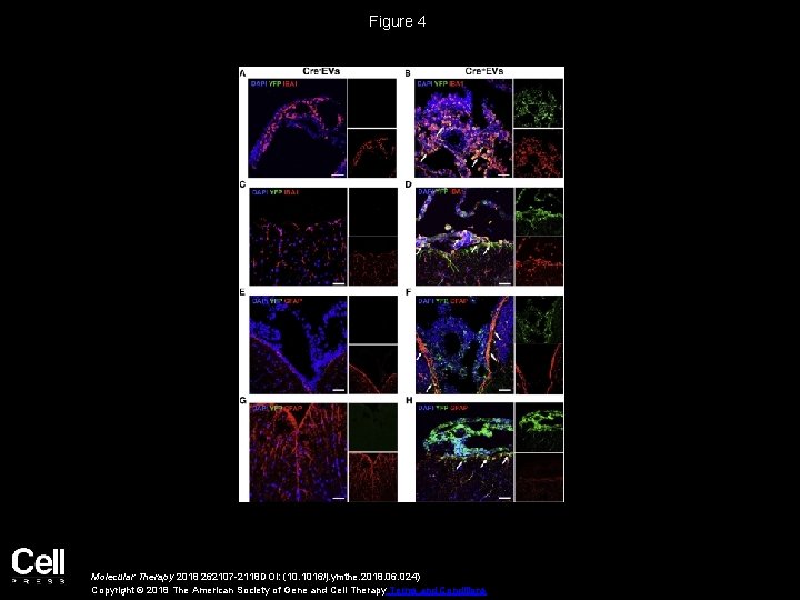 Figure 4 Molecular Therapy 2018 262107 -2118 DOI: (10. 1016/j. ymthe. 2018. 06. 024)