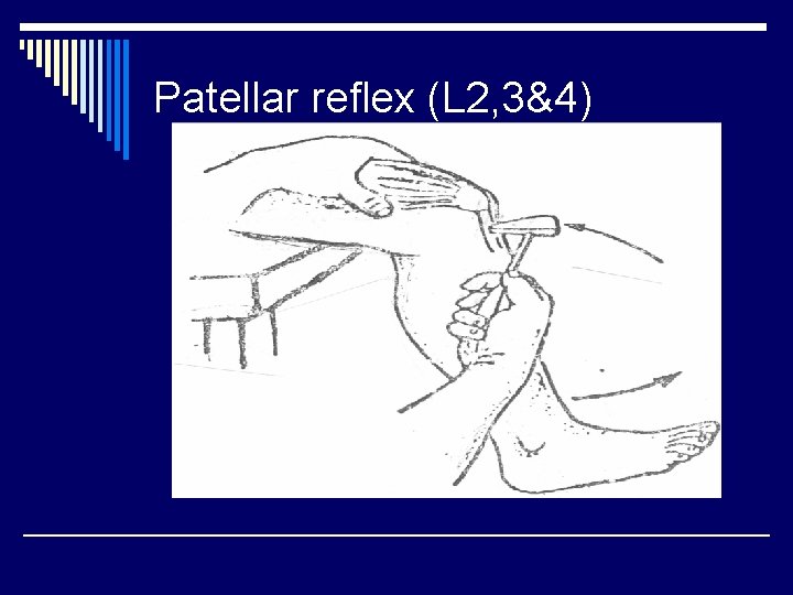 Patellar reflex (L 2, 3&4) 