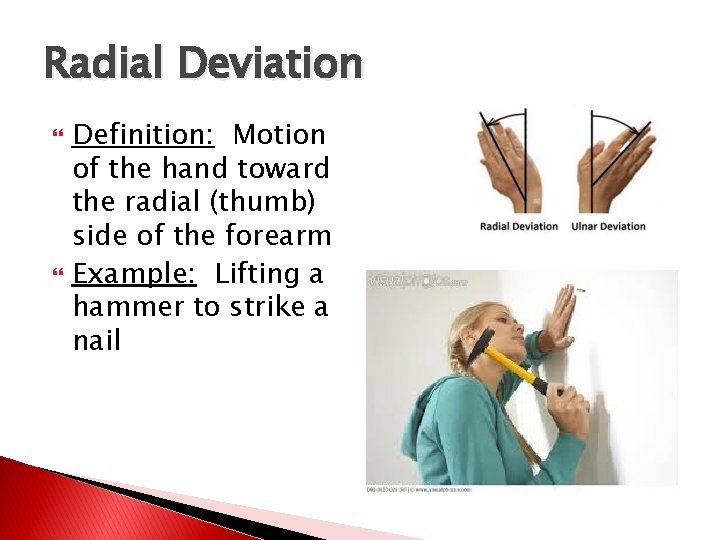 Radial Deviation Definition: Motion of the hand toward the radial (thumb) side of the