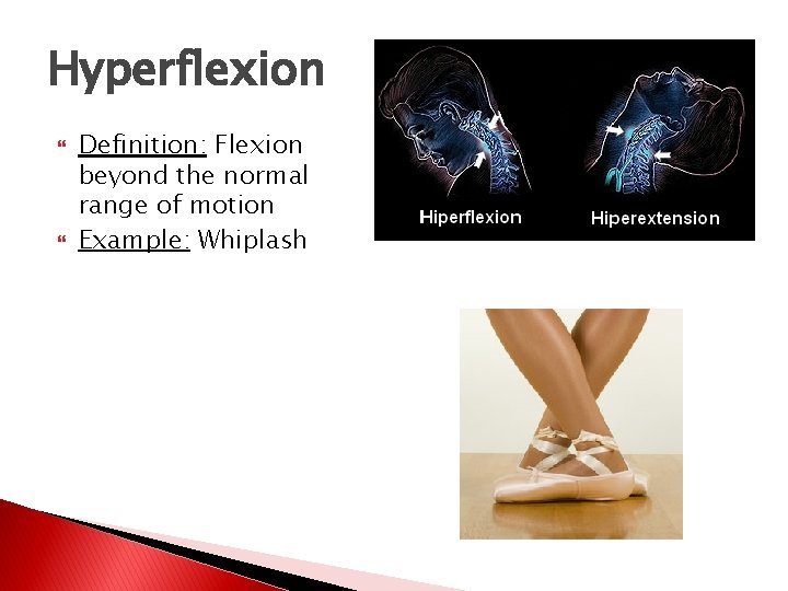 Hyperflexion Definition: Flexion beyond the normal range of motion Example: Whiplash 