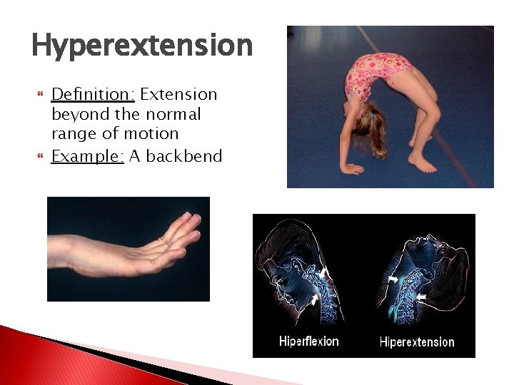 Hyperextension Definition: Extension beyond the normal range of motion Example: A backbend 