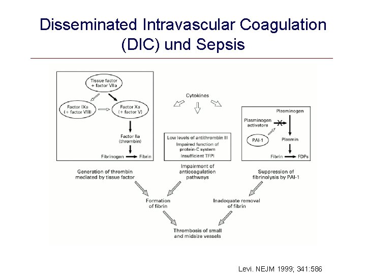 Disseminated Intravascular Coagulation (DIC) und Sepsis Levi. NEJM 1999; 341: 586 
