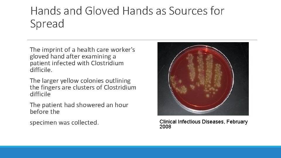Hands and Gloved Hands as Sources for Spread The imprint of a health care