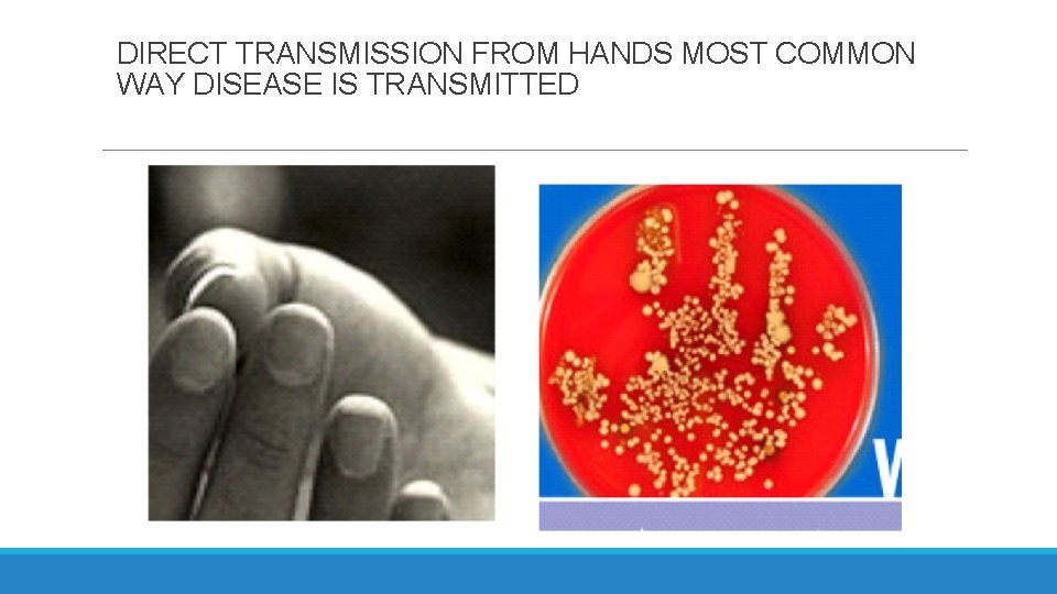 DIRECT TRANSMISSION FROM HANDS MOST COMMON WAY DISEASE IS TRANSMITTED 