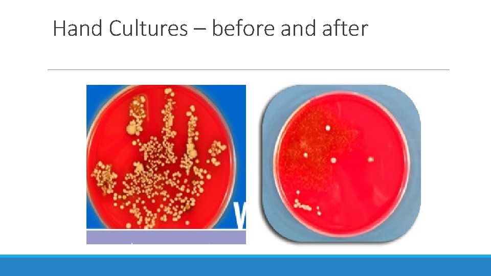 Hand Cultures – before and after 