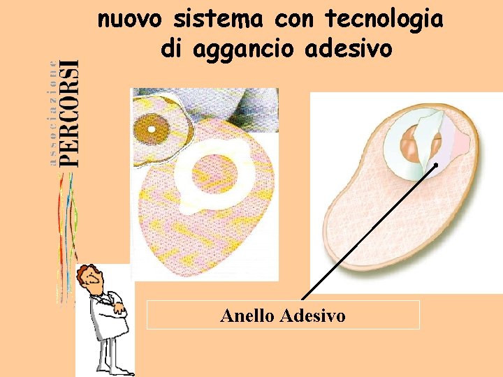 nuovo sistema con tecnologia di aggancio adesivo Anello Adesivo 