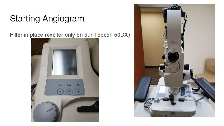 Starting Angiogram Filter in place (exciter only on our Topcon 50 DX) 