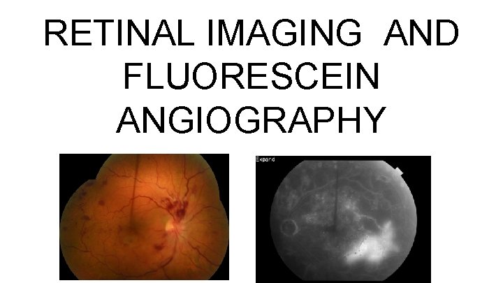 RETINAL IMAGING AND FLUORESCEIN ANGIOGRAPHY 