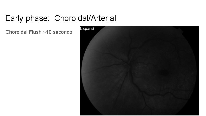 Early phase: Choroidal/Arterial Choroidal Flush ~10 seconds 