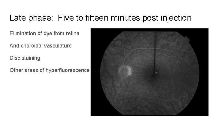 Late phase: Five to fifteen minutes post injection Elimination of dye from retina And