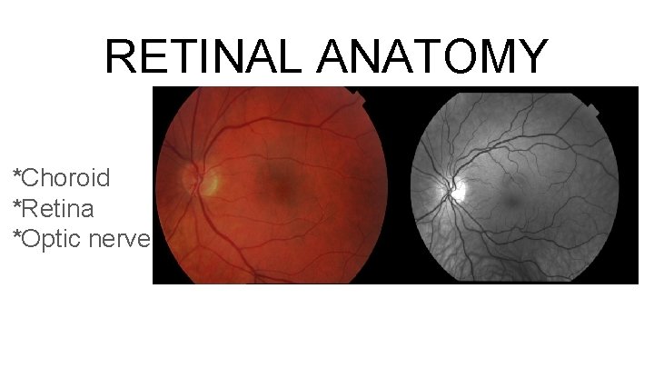 RETINAL ANATOMY *Choroid *Retina *Optic nerve 