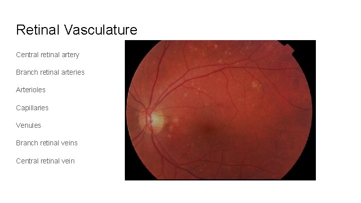 Retinal Vasculature Central retinal artery Branch retinal arteries Arterioles Capillaries Venules Branch retinal veins