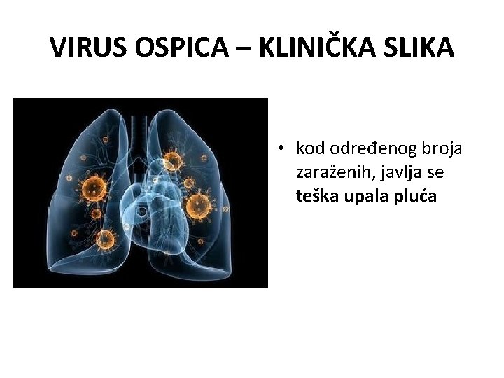VIRUS OSPICA – KLINIČKA SLIKA • kod određenog broja zaraženih, javlja se teška upala
