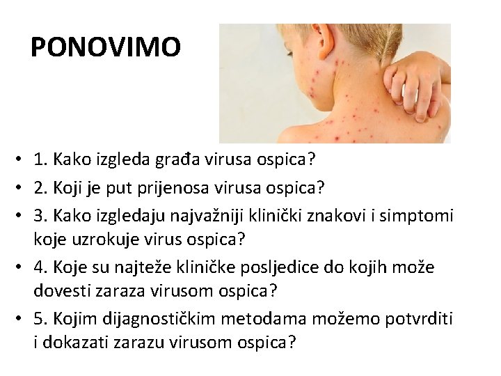 PONOVIMO • 1. Kako izgleda građa virusa ospica? • 2. Koji je put prijenosa